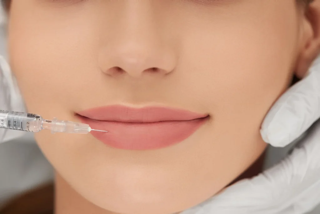 lip enhancement brighton subtle lip filler