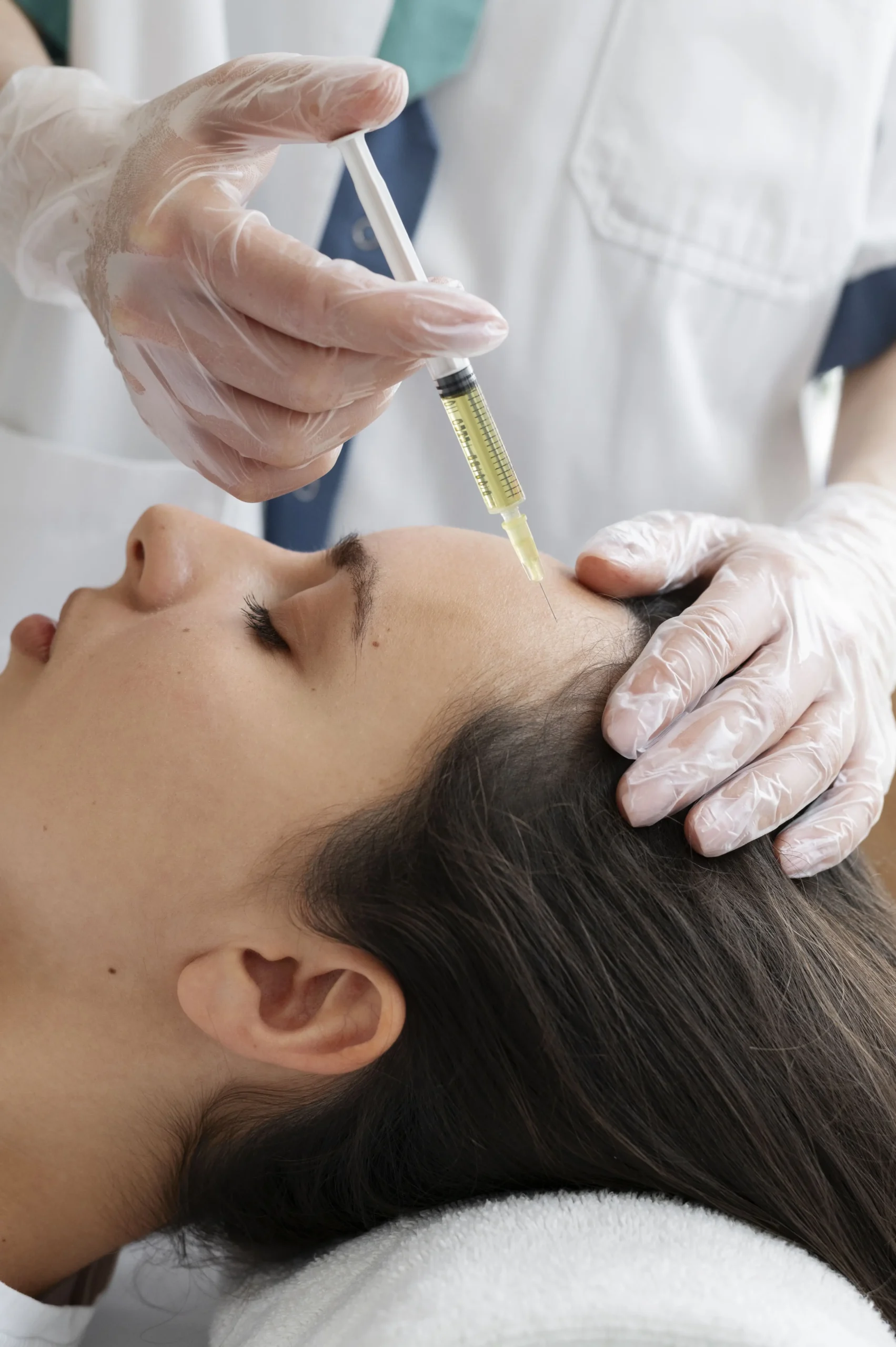 Top 5 Benefits of PRP Facial