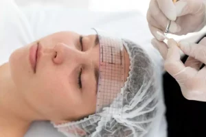 PDO Threads vs. Traditional Facelifts: Which Is Right for You?