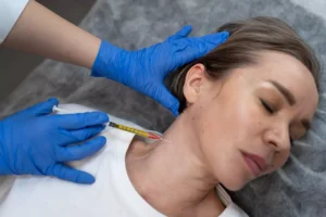 PDO Thread Lift Benefits and Side Effects