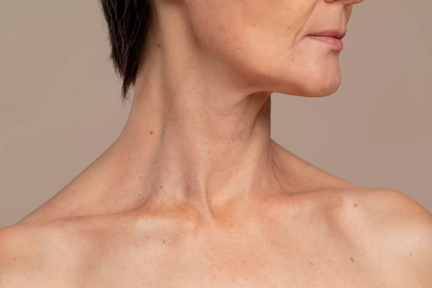 How to Transform Your Neck Aging Without Surgery