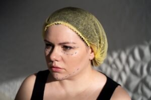 Natural Results vs. Overdone: SaRivaa’s Subtle Approach Explained