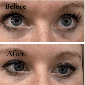 lumie eyes best results