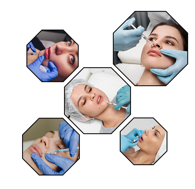 lip injections brighton