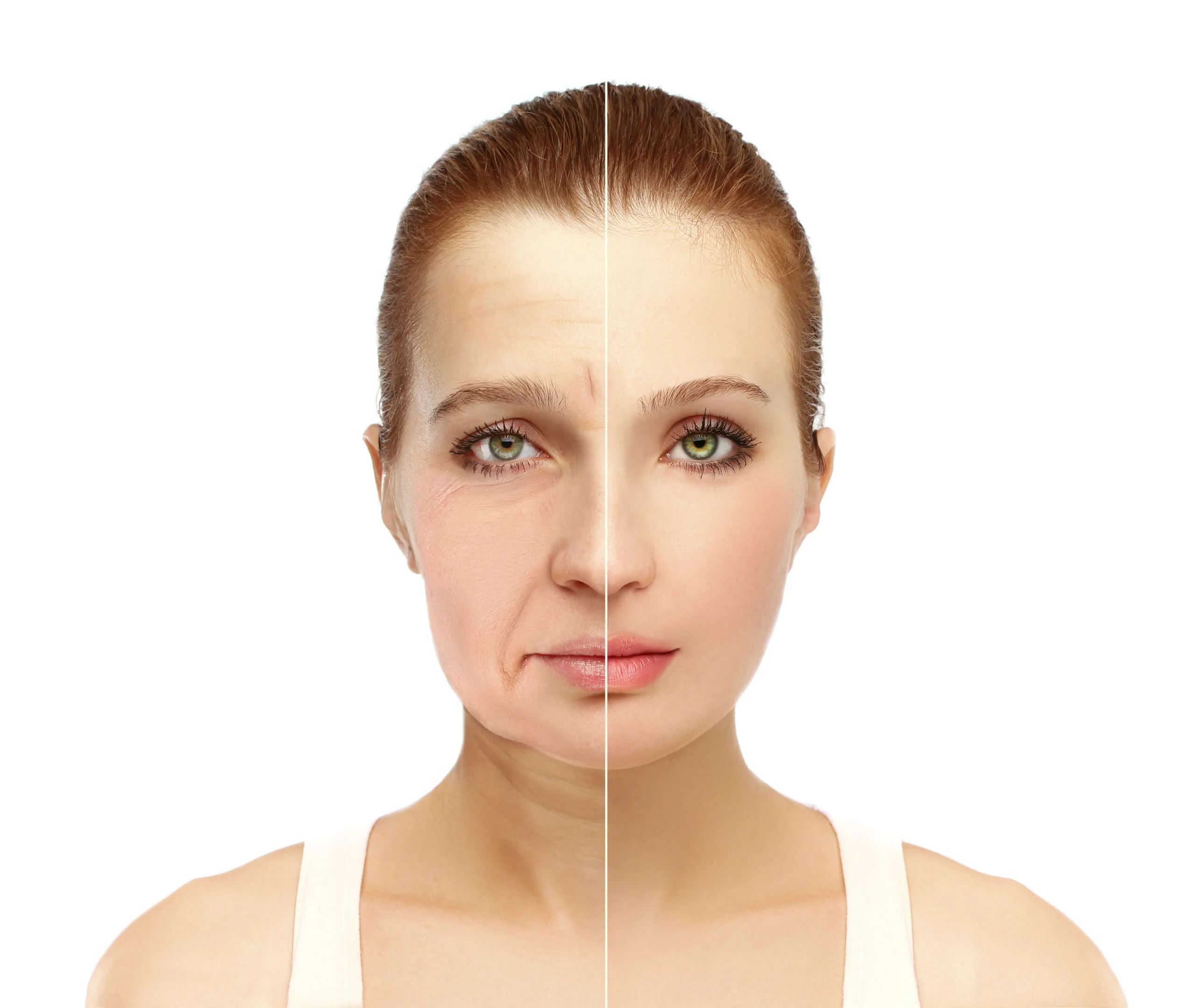 plastic-surgery-results-nasolabial-folds-eye-circles-neck-lines-1.webp