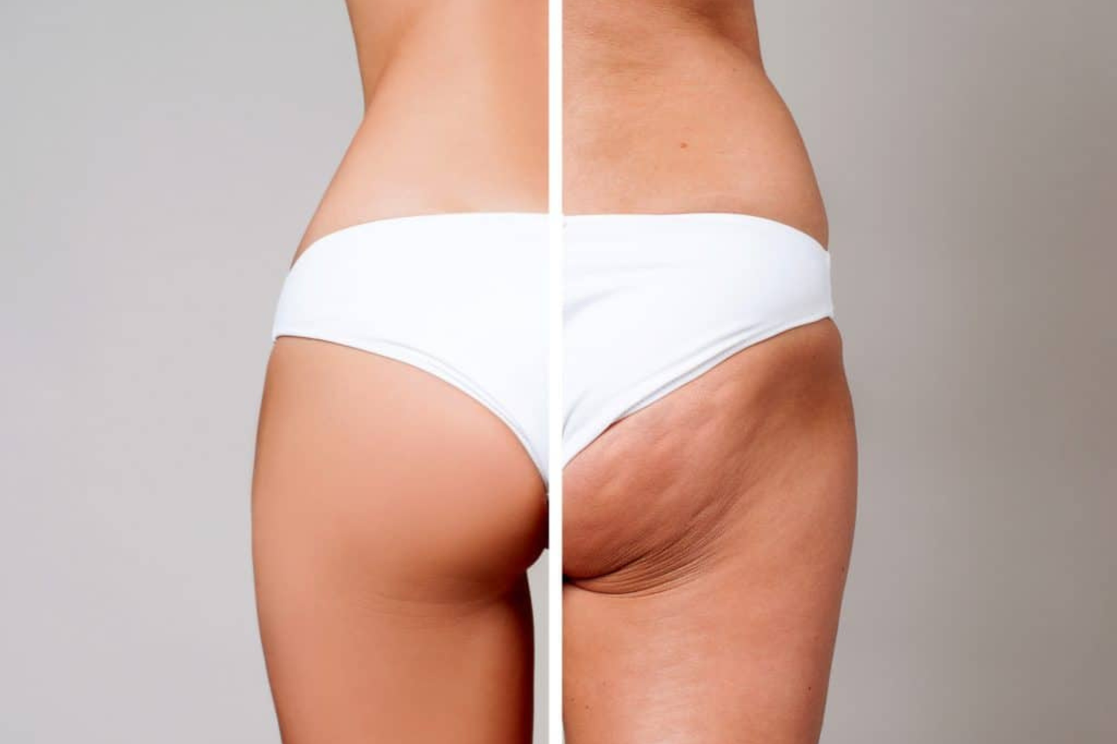 lanluma body filler​