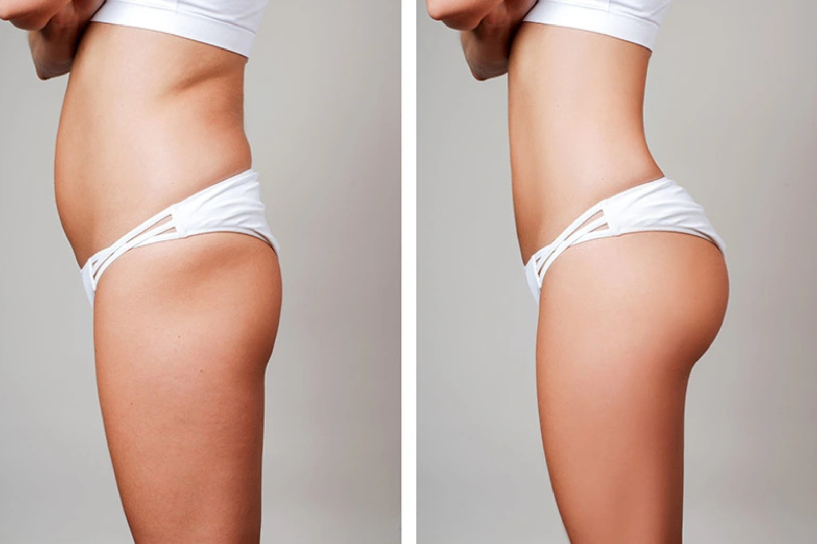 lanluma treatment​ in Brighton