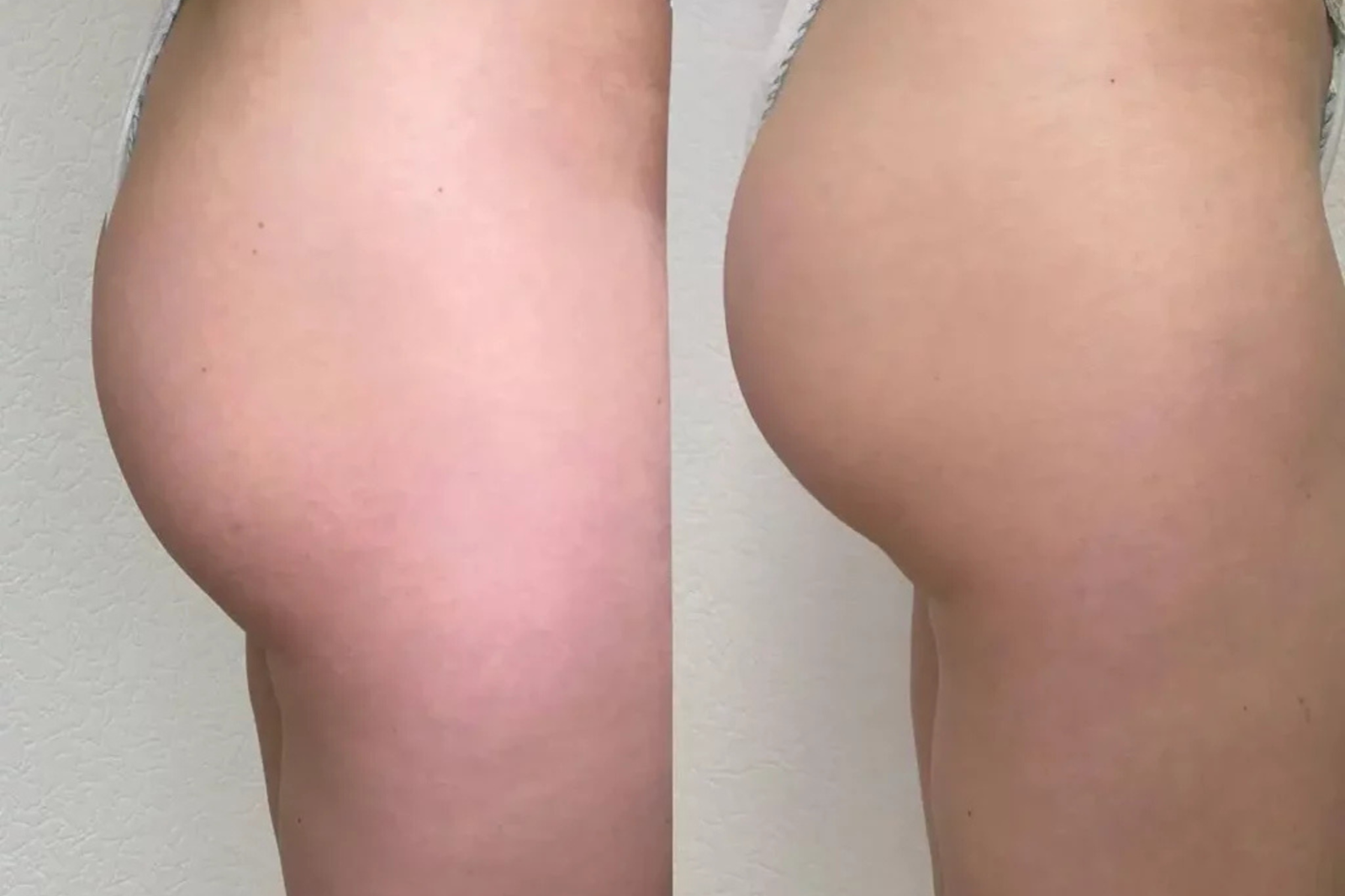 lanluma treatment near me​