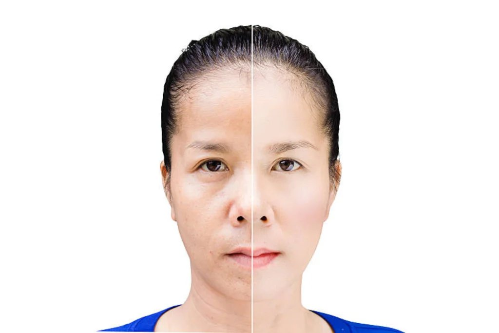 iv nutritional therapy