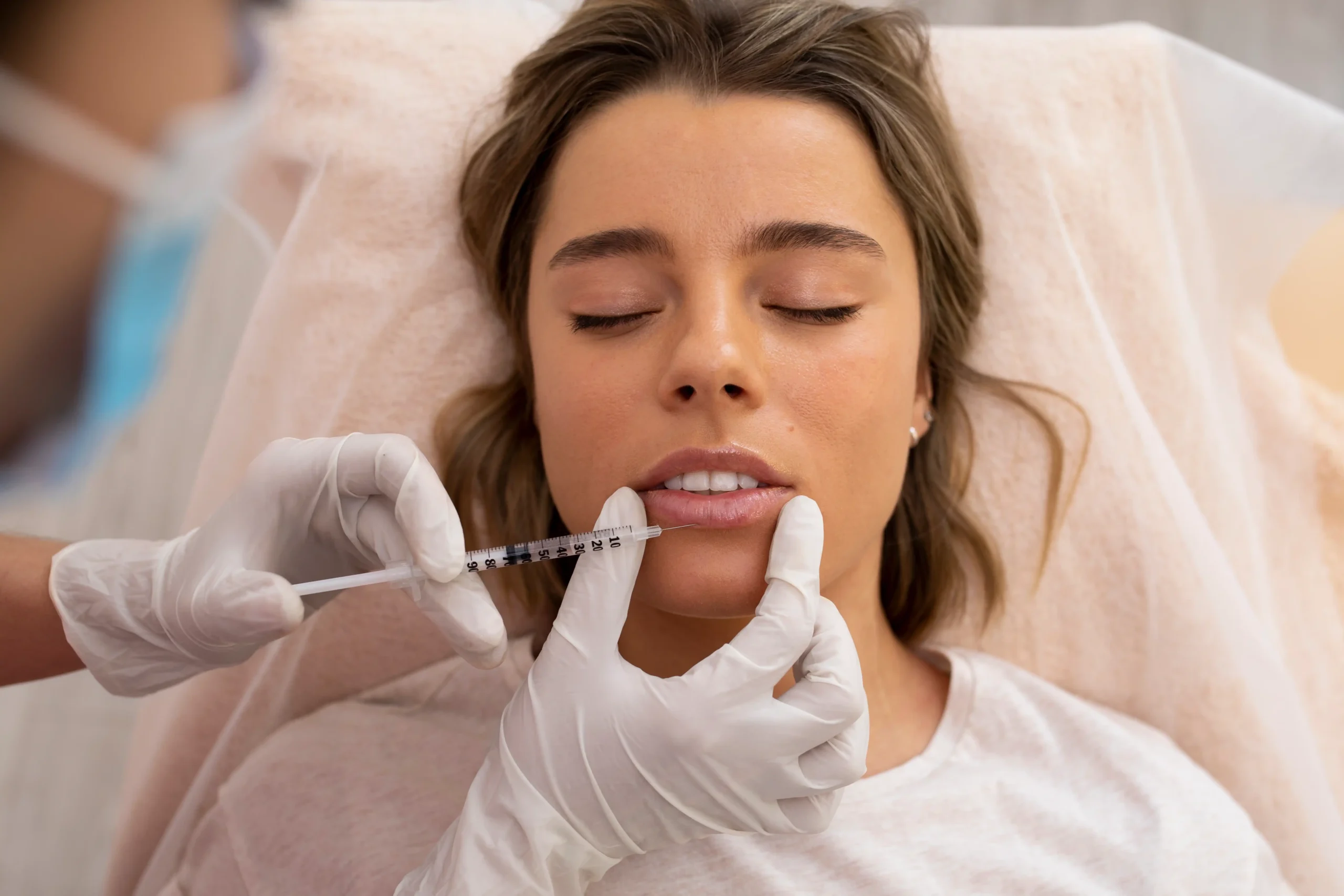 Anti-aging lip fillers

