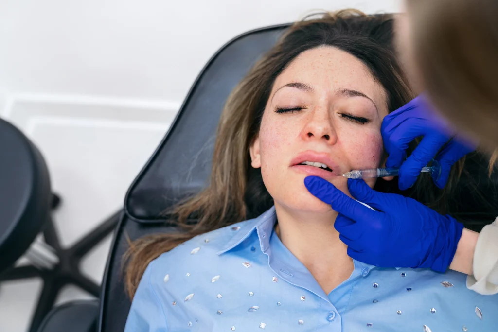 lip fillers in winter