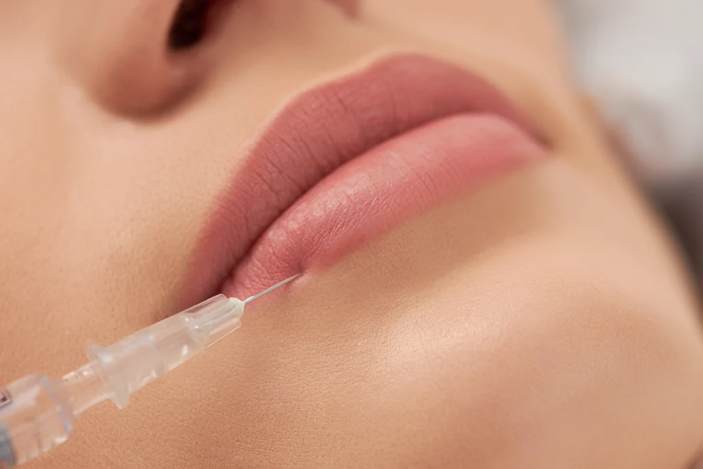 Best age for lip fillers