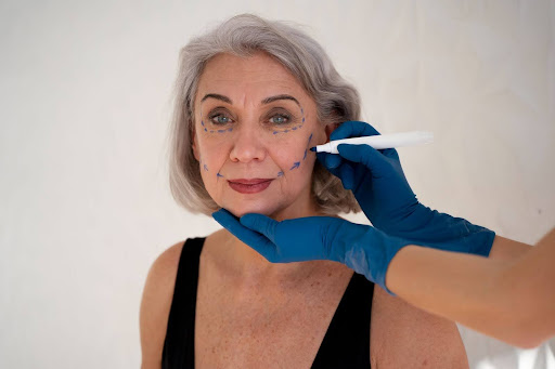 Fine Lines and Wrinkles treatment