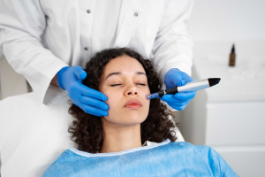 Radiofrequency Microneedling: Everything You Need to Know