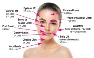 Botox Dosage Differences: Why Your Units May Be Higher