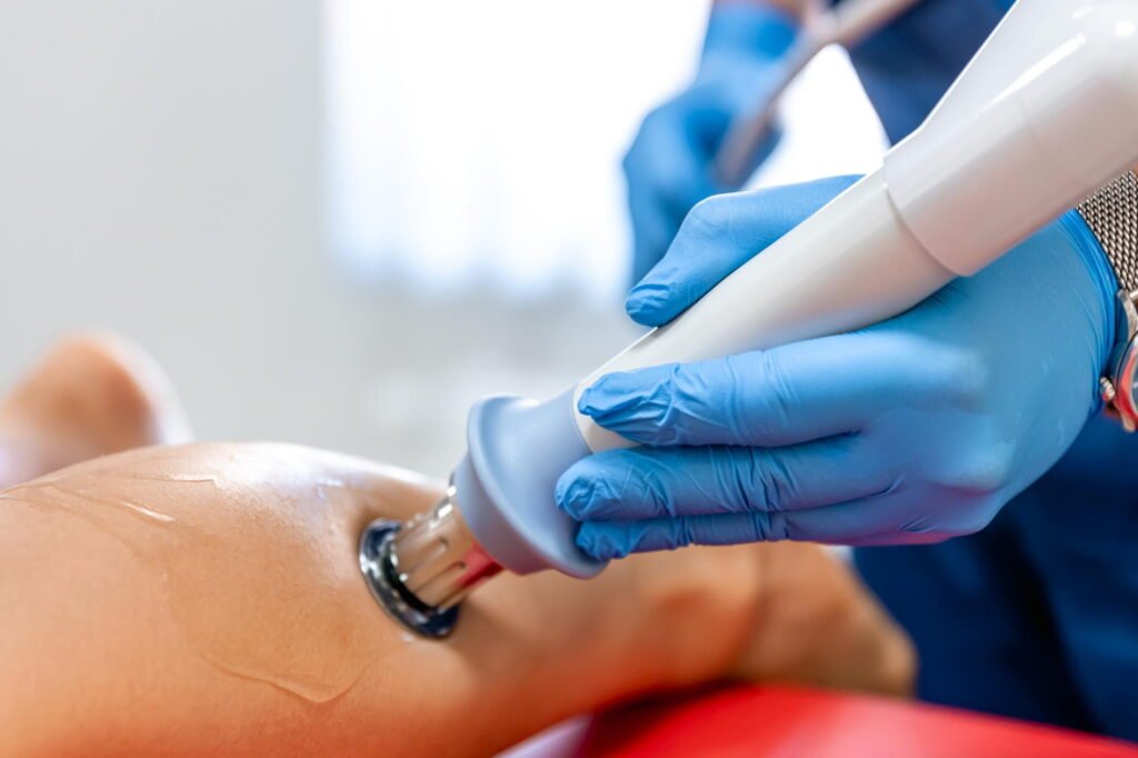 sclerotherapy treatment